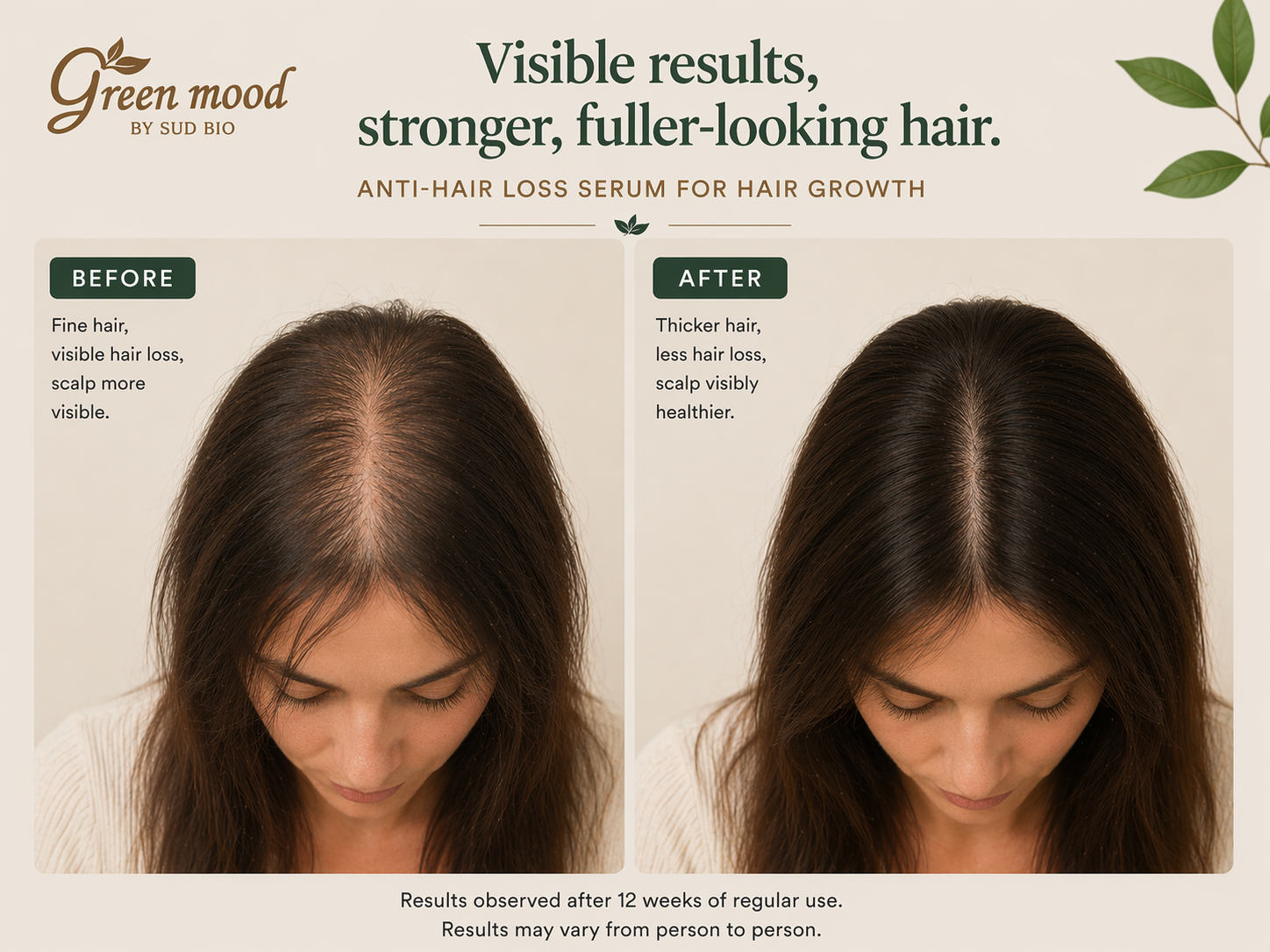 before after anti hair loss serum results hair growth green mood