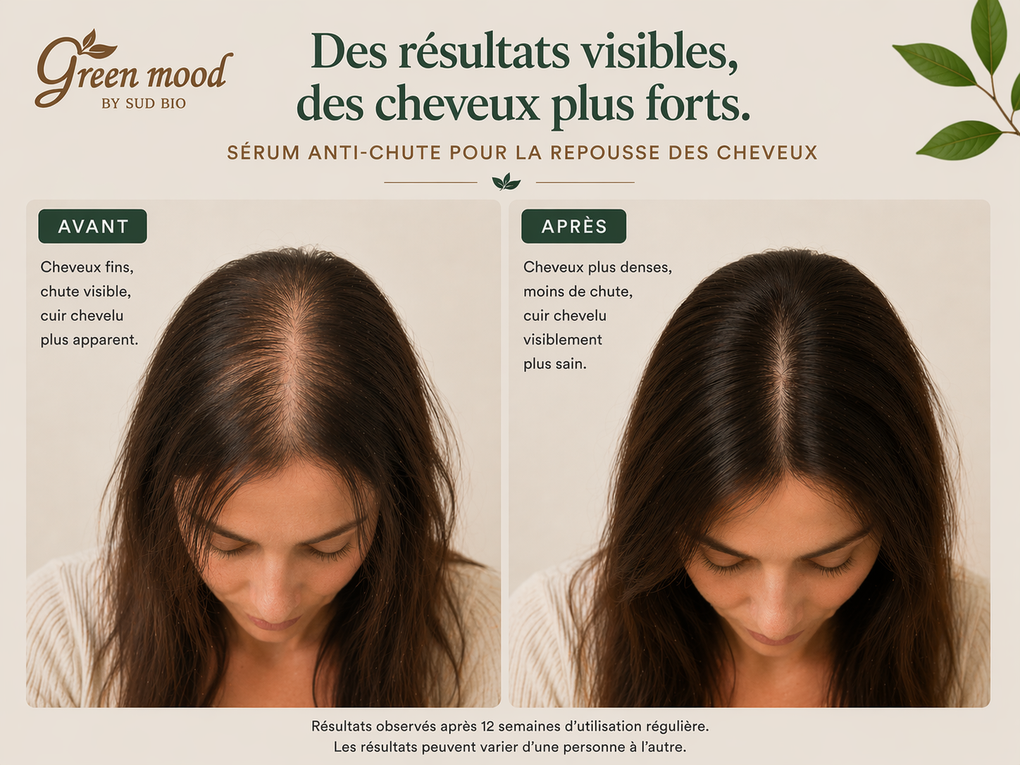 Avant-après Sérum Anti-Chute Green Mood — cheveux visiblement plus forts et mieux entretenus